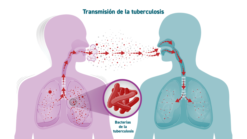 https://www.cdc.gov/tb/es/causes/causas.html
