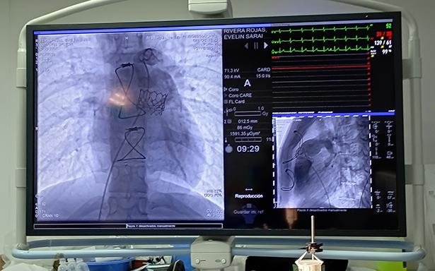 https://www.imss.gob.mx/prensa/archivo/202604/224